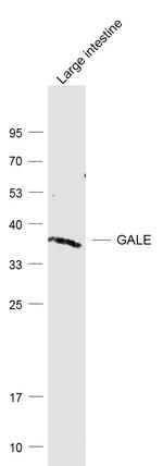 GALE/Galactowaldenase Antibody in Western Blot (WB)