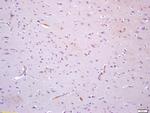 TIE1 Antibody in Immunohistochemistry (Paraffin) (IHC (P))