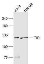 TIE1 Antibody in Western Blot (WB)