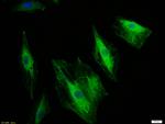 CK18 Antibody in Immunocytochemistry (ICC/IF)