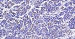 CK18 Antibody in Immunohistochemistry (Paraffin) (IHC (P))