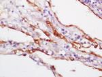 CK18 Antibody in Immunohistochemistry (Paraffin) (IHC (P))