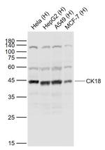 CK18 Antibody in Western Blot (WB)