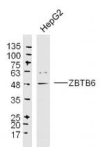 ZBTB6/ZNF482 Antibody in Western Blot (WB)