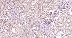 CLEC9A Antibody in Immunohistochemistry (Paraffin) (IHC (P))