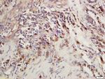 CEP120 Antibody in Immunohistochemistry (Paraffin) (IHC (P))