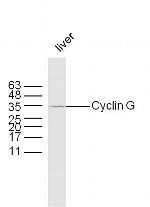 Cyclin G Antibody in Western Blot (WB)