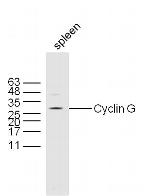 Cyclin G Antibody in Western Blot (WB)