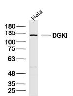 DGKI Antibody in Western Blot (WB)