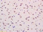 VDAC Antibody in Immunohistochemistry (Paraffin) (IHC (P))