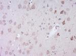 EXOC1 Antibody in Immunohistochemistry (Paraffin) (IHC (P))