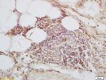 C1orf106 Antibody in Immunohistochemistry (Paraffin) (IHC (P))