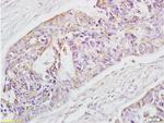 EpCAM/CD326 Antibody in Immunohistochemistry (Paraffin) (IHC (P))