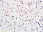 Phospho-LKB1 (Thr363) Antibody in Immunohistochemistry (Paraffin) (IHC (P))