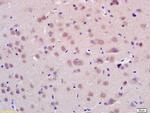 CHIP Antibody in Immunohistochemistry (Paraffin) (IHC (P))