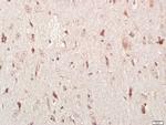 HEG1 Antibody in Immunohistochemistry (Paraffin) (IHC (P))