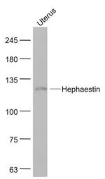 Hephaestin Antibody in Western Blot (WB)