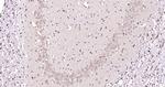 HERPUD1 Antibody in Immunohistochemistry (Paraffin) (IHC (P))