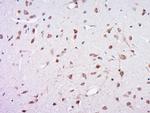 Profilin 1 Antibody in Immunohistochemistry (Paraffin) (IHC (P))