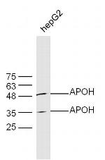 APOH Antibody in Western Blot (WB)