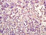 Phospho-ERK1 (Thr183, Tyr185) Antibody in Immunohistochemistry (Paraffin) (IHC (P))