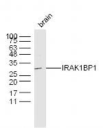 IRAK1BP1 Antibody in Western Blot (WB)