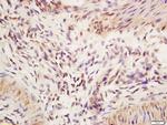 IRF2 Antibody in Immunohistochemistry (Paraffin) (IHC (P))