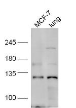 HNRPUL1 Antibody in Western Blot (WB)