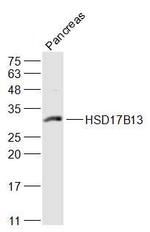 HSD17B13 Antibody in Western Blot (WB)
