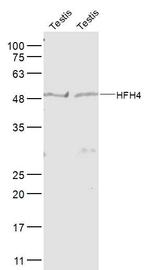 FOXJ1/HFH-4 Antibody in Western Blot (WB)