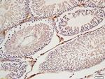 Cyclin H Antibody in Immunohistochemistry (Paraffin) (IHC (P))