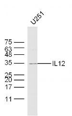 IL-12 Antibody in Western Blot (WB)