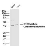 OTC Antibody in Western Blot (WB)