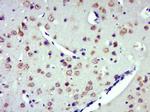 ZDHHC8 Antibody in Immunohistochemistry (Paraffin) (IHC (P))