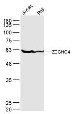 ZCCHC4 Antibody in Western Blot (WB)