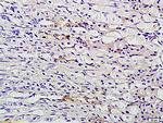 TFF2 Antibody in Immunohistochemistry (Paraffin) (IHC (P))