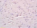 LCAT Antibody in Immunohistochemistry (Paraffin) (IHC (P))