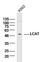 LCAT Antibody in Western Blot (WB)