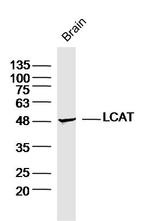 LCAT Antibody in Western Blot (WB)