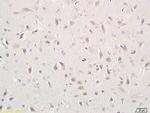 CD171/NCAM-L1 Antibody in Immunohistochemistry (Paraffin) (IHC (P))