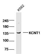 KCNT1 Antibody in Western Blot (WB)