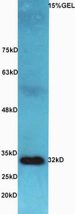 AQP9 Antibody in Western Blot (WB)