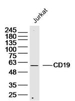 CD19 Antibody in Western Blot (WB)