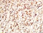 Ki-67 proliferation Marker Antibody in Immunohistochemistry (Paraffin) (IHC (P))