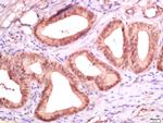 Ki-67 proliferation Marker Antibody in Immunohistochemistry (Paraffin) (IHC (P))