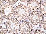 Ki-67 proliferation Marker Antibody in Immunohistochemistry (Paraffin) (IHC (P))