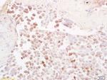 NQO1 Antibody in Immunohistochemistry (Paraffin) (IHC (P))