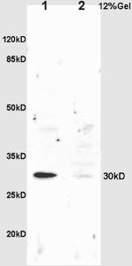 NQO1 Antibody in Western Blot (WB)