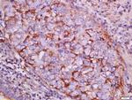 pan-Cytokeratin Antibody in Immunohistochemistry (Paraffin) (IHC (P))