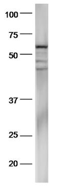 pan-Cytokeratin Antibody in Western Blot (WB)